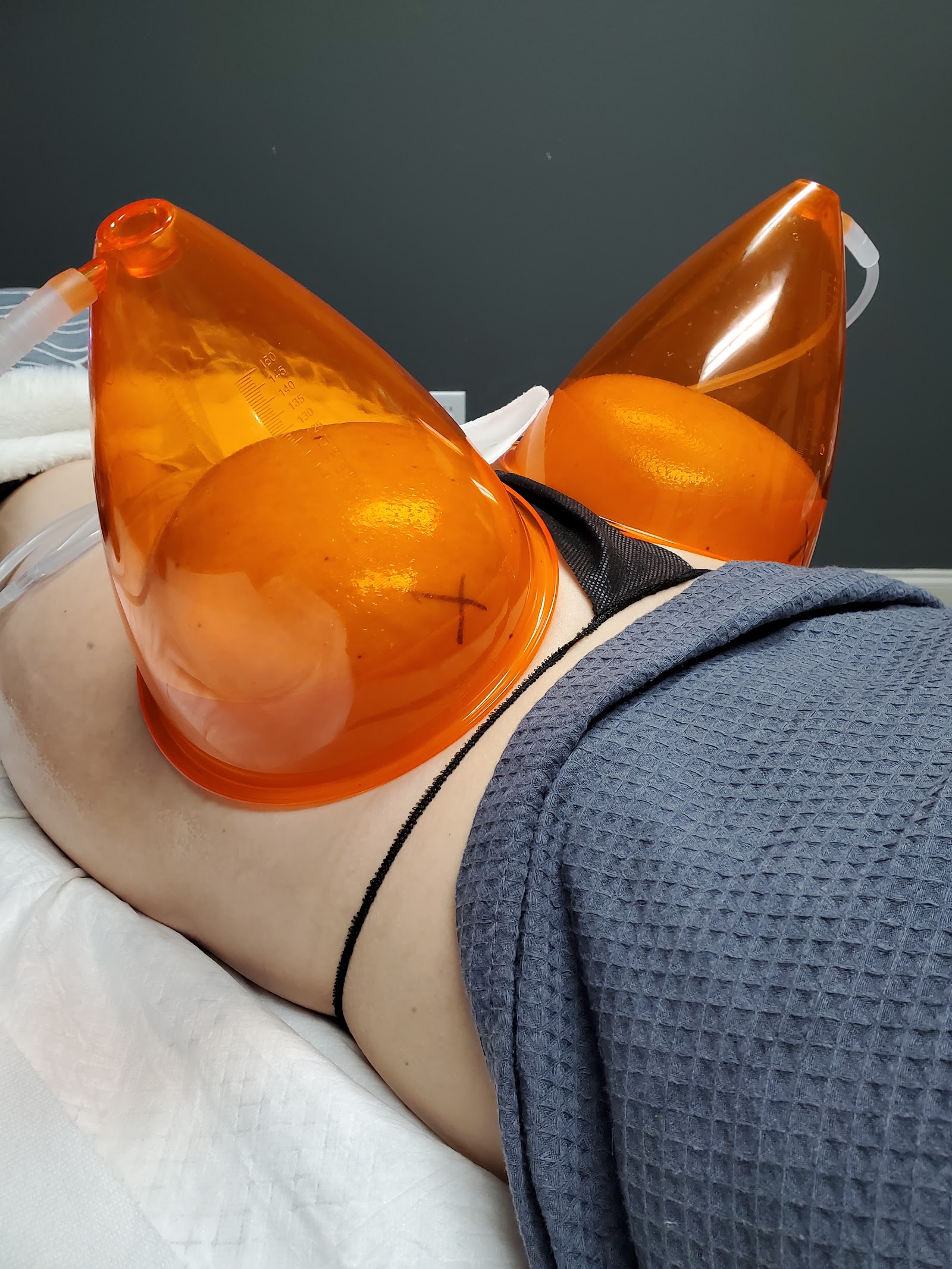 Geaux Cryo Sculpting Spa